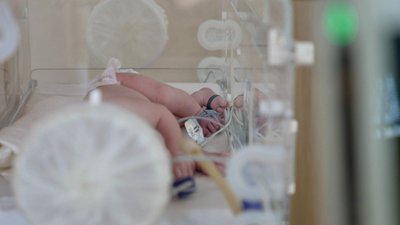 Бокс для недоношених діток, пологовий, немовля Бокс для недоношених діток, пологовий, немовля