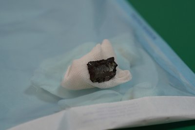 Осколок поранив шию: на Дніпропетровщині лікують вагітну з Херсонщини, яка потрапила під обстріл РФ Осколок поранив шию: на Дніпропетровщині лікують вагітну з Херсонщини, яка потрапила під обстріл РФ
