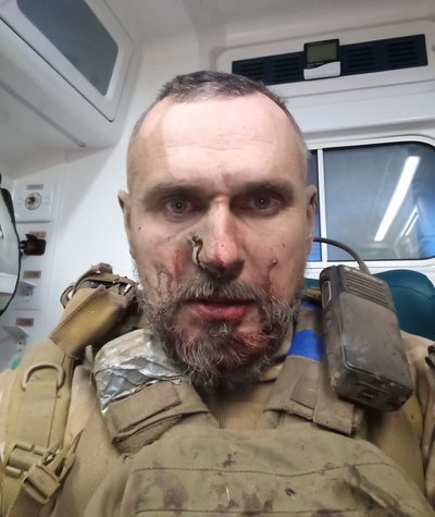 Український режисер Олег Сенцов потрапив під артилерійський обстріл