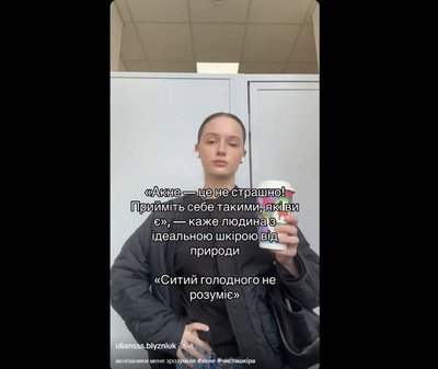 Чому люди все менше приховують акне та як це перетворилося на тренд Чому люди все менше приховують акне та як це перетворилося на тренд