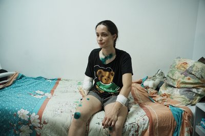 Олександра Щебілова проходить лікування після важкого поранення після удару РФ в Харкові Олександра Щебілова проходить лікування після важкого поранення після удару РФ в Харкові