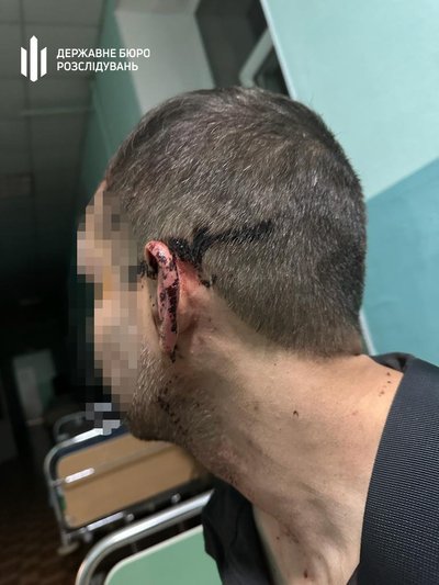 В одній із військових частин на Одещині побили військового В одній із військових частин на Одещині побили військового
