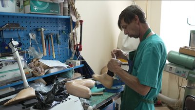 Протезування у Полтаві: де виконують та хто може звернутися Протезування у Полтаві: де виконують та хто може звернутися
