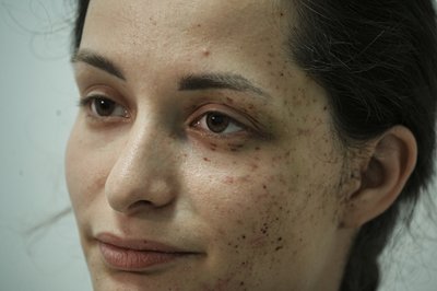 Поранена рятувальниця з Харкова Олександра Щебілова Поранена рятувальниця з Харкова Олександра Щебілова