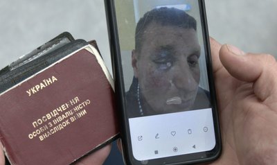 ДБР повернуло в Нацполіцію справу про побиття ветерана у Луцьку
