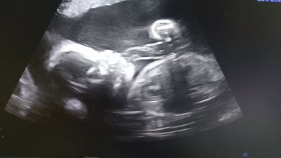У Полтавському обласному перинатальному центрі загинуло одноденне немовля: у чому причина У Полтавському обласному перинатальному центрі загинуло одноденне немовля: у чому причина