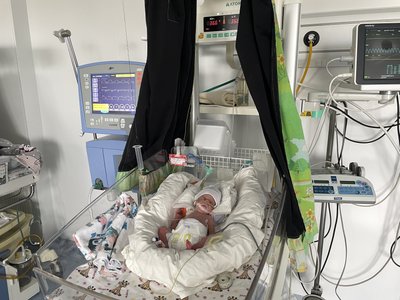 Як Японія допомагає Полтаві із обладнанням для недоношених дітей