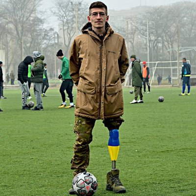 Втратив ногу та пальці руки, а зараз допомагає іншим: історія військового з Одеси