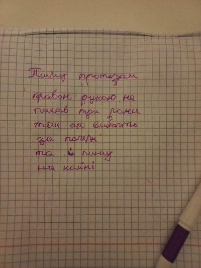 "Протезом навчився писати": що треба знати про біонічні протези та як їх виготовляють у Чернівцях "Протезом навчився писати": що треба знати про біонічні протези та як їх виготовляють у Чернівцях