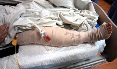 У харківському шпиталі змогли зберегти ногу бійцю, якого понад добу не могли евакуювати У харківському шпиталі змогли зберегти ногу бійцю, якого понад добу не могли евакуювати