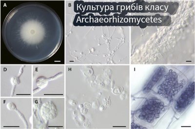 Гриби Archaeorhizomyces borealis у Слобожанському національному природному парку Гриби Archaeorhizomyces borealis у Слобожанському національному природному парку