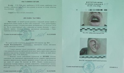 Закинули в авто, побили та викинули на покинутій АЗС. Ветеран з Дніпра заявляє про викрадення військовими ТЦК Закинули в авто, побили та викинули на покинутій АЗС. Ветеран з Дніпра заявляє про викрадення військовими ТЦК
