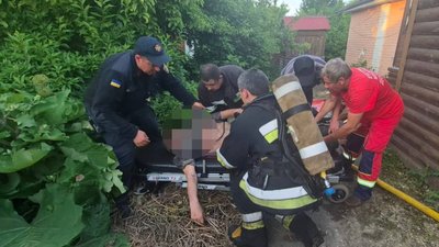 Пожежа будинку на Чернігівщині: через куріння загорівся будинок, чоловіка госпіталізували Пожежа будинку на Чернігівщині: через куріння загорівся будинок, чоловіка госпіталізували