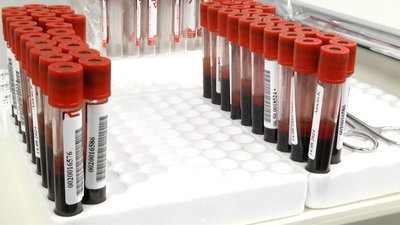 День донора в Житомирській лікарні: медики здали кров для потреб ЗСУ День донора в Житомирській лікарні: медики здали кров для потреб ЗСУ