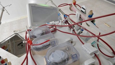 Трансплантація органів: як лікують та оперують пацієнтів у двох лікарнях в Луцьку Трансплантація органів: як лікують та оперують пацієнтів у двох лікарнях в Луцьку