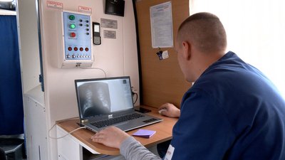 У Вінниці до Дня боротьби з туберкульозом працювала мобільна лабораторія У Вінниці до Дня боротьби з туберкульозом працювала мобільна лабораторія