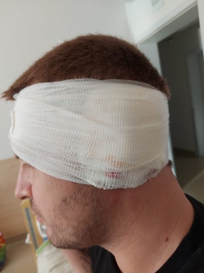 "Моя задача, щоб Дніпро не став спогадом". Як попри часткову втрату зору працює оператор БпЛА 128-ї ОВМБр "Моя задача, щоб Дніпро не став спогадом". Як попри часткову втрату зору працює оператор БпЛА 128-ї ОВМБр