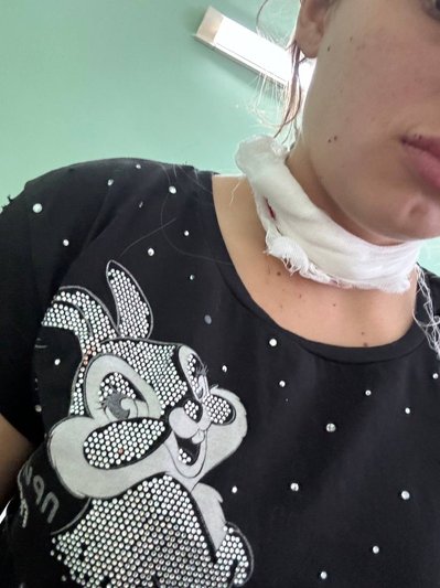 "Скинув прямо на мене, граната покотилась і вибухнула під ногами". Херсонку Анастасію Павленко двічі атакували дрони РФ "Скинув прямо на мене, граната покотилась і вибухнула під ногами". Херсонку Анастасію Павленко двічі атакували дрони РФ