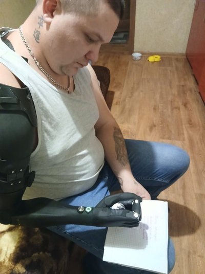 "Протезом навчився писати": що треба знати про біонічні протези та як їх виготовляють у Чернівцях "Протезом навчився писати": що треба знати про біонічні протези та як їх виготовляють у Чернівцях