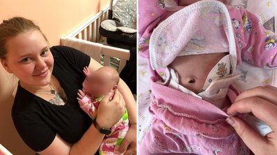 Лікарку Полтавського перинатального центру, яка не помітили у новонародженої атрезію ануса, отримала догану Лікарку Полтавського перинатального центру, яка не помітили у новонародженої атрезію ануса, отримала догану