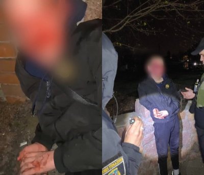 На Київщині підлітки побили дитину до втрати свідомості На Київщині підлітки побили дитину до втрати свідомості