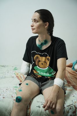 21-річна рятувальниця з Харкова Олександра Щебілова у лікарні 21-річна рятувальниця з Харкова Олександра Щебілова у лікарні