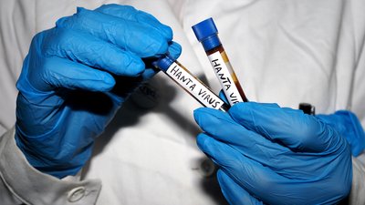 Хантавірус і лептоспіроз: чернігівські епідеміологи розповіли, чим небезпечні інфекції, що передаються гризунами Хантавірус і лептоспіроз: чернігівські епідеміологи розповіли, чим небезпечні інфекції, що передаються гризунами