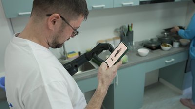 У Вінниці ветерани та цивільні з ампутаціями вчаться жити самостійно з біонічними протезами У Вінниці ветерани та цивільні з ампутаціями вчаться жити самостійно з біонічними протезами