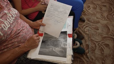 Сподіваються, що дитина нормально ходитиме: родина з Чернігівщини збирає гроші на імпланти для 8-річної дівчинки Сподіваються, що дитина нормально ходитиме: родина з Чернігівщини збирає гроші на імпланти для 8-річної дівчинки