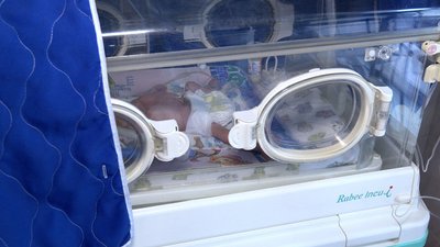 На Вінниччині народились трійнята та двійнята: історії породіль і медиків На Вінниччині народились трійнята та двійнята: історії породіль і медиків