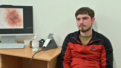 "Я звернулася, бо є новоутворення": як перевіряли родимкі у День діагностики меланоми у Рівному