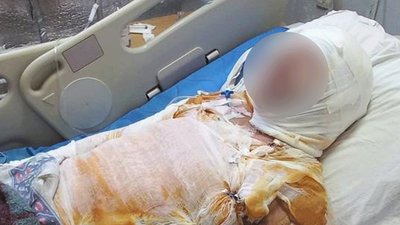 34-річного чоловіка викрали, облили фарбою і підпалили біля селища на Миколаївщині: постраждалий у важкому стані 34-річного чоловіка викрали, облили фарбою і підпалили біля селища на Миколаївщині: постраждалий у важкому стані
