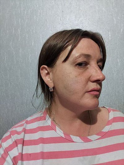 Олена Погонцева після нападу Олена Погонцева після нападу