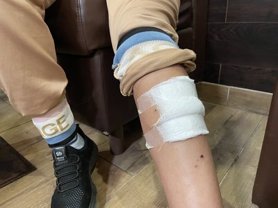 "Скинув прямо на мене, граната покотилась і вибухнула під ногами". Херсонку Анастасію Павленко двічі атакували дрони РФ "Скинув прямо на мене, граната покотилась і вибухнула під ногами". Херсонку Анастасію Павленко двічі атакували дрони РФ