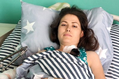 У якому стані люди, які отримали травми внаслідок обстрілу Глухова 27 липня У якому стані люди, які отримали травми внаслідок обстрілу Глухова 27 липня