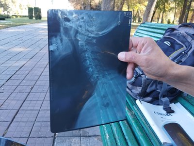 ВЛК не враховує приватні обстеження бійця з Полтавщини, який доводить непридатність до служби ВЛК не враховує приватні обстеження бійця з Полтавщини, який доводить непридатність до служби