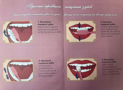 Чому в дітей псуються зуби і як цьому зарадити — поради дитячого стоматолога з Житомира