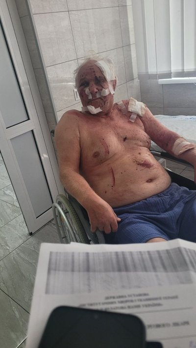 "Дивом лишились живі": росіяни атакували село на Одещині, є поранені "Дивом лишились живі": росіяни атакували село на Одещині, є поранені