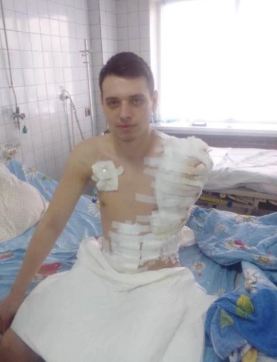 Двісті дев'яносто вдев'ятий день війни. Хроніка подій в Одеській області Двісті дев'яносто вдев'ятий день війни. Хроніка подій в Одеській області