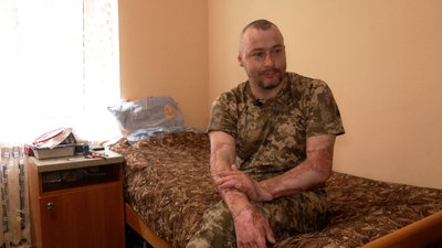 "Зняли бинти — і почав вишивати": як боєць із Чернігівщини, який має 36% опіків тіла, відновлюється після поранення "Зняли бинти — і почав вишивати": як боєць із Чернігівщини, який має 36% опіків тіла, відновлюється після поранення