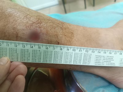 Побиття військовослужбовців цивільними: свідки та сторони події розповіли, що сталося у Бузькому Побиття військовослужбовців цивільними: свідки та сторони події розповіли, що сталося у Бузькому