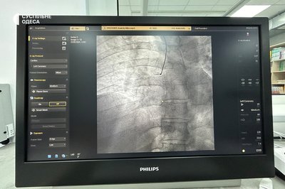 У лікарні на Одещини тестують сучасний ангіограф, за допомогою якого будуть проводити операції на серці У лікарні на Одещини тестують сучасний ангіограф, за допомогою якого будуть проводити операції на серці