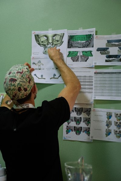 Симетрію обличчя завдяки 3D-друку та фрагменту ребра відновили дівчині з Рівненщини Симетрію обличчя завдяки 3D-друку та фрагменту ребра відновили дівчині з Рівненщини