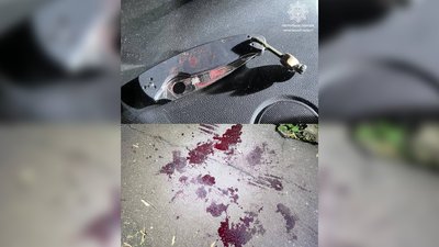 Поліцейські у Чернігові затримали чоловіка, який кидався на людей з ножем Поліцейські у Чернігові затримали чоловіка, який кидався на людей з ножем