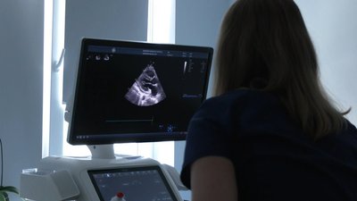 У Львівському центрі трансплантології виконали понад 100 пересадок органів впродовж року У Львівському центрі трансплантології виконали понад 100 пересадок органів впродовж року