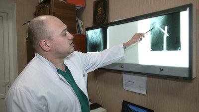 Рентген ноги Рентген ноги