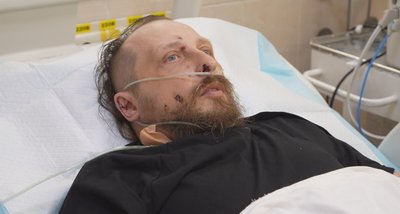 Отямився вже в реанімації. У медзакладі Дніпропетровщини лікують бійця, який потрапив під атаку дронів Отямився вже в реанімації. У медзакладі Дніпропетровщини лікують бійця, який потрапив під атаку дронів