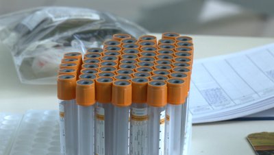 Як працює Волинський центр служби крові та що потрібно знати, щоб стати донором Як працює Волинський центр служби крові та що потрібно знати, щоб стати донором