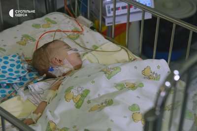 Одеські лікарі провели першу у світі операцію з вживлення електрода в систему серця немовляти Одеські лікарі провели першу у світі операцію з вживлення електрода в систему серця немовляти