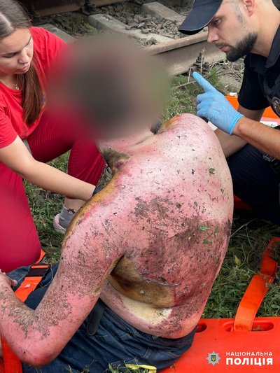 Залізли на дах потяга: на Одещині уразило струмом двох підлітків Залізли на дах потяга: на Одещині уразило струмом двох підлітків